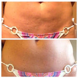 ageLOC® Dermatic Effects