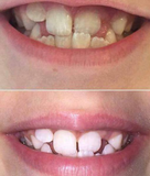 AP 24® Whitening Fluoride Toothpaste