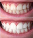AP 24® Whitening Fluoride Toothpaste