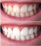 AP 24® Whitening Fluoride Toothpaste